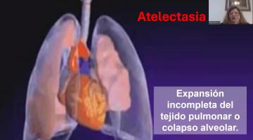 Fisiopatología 2025. Respiratorio II.