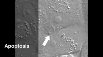 Una célula decide morir - Apoptosis - Biología Celular y Molecular