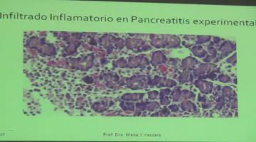 Fisiopato 2017 17 de Abril Fisiopatología Pancreática