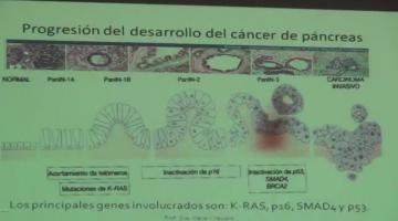 Fisiopato 2017 18 de Abril Fisiopatología Pancreática II