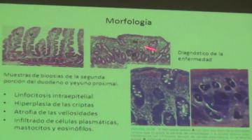 Fisiopato 2017, 24 de Abril. Fisiopatología Intestinal. Enfermedad Celíaca y enfermedades inflamatorias intestinales.