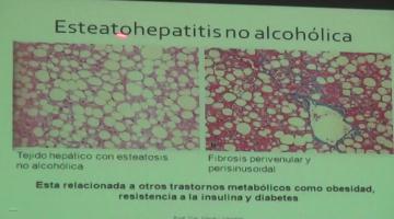 Fisiopato 2017, 23 de Mayo. Fisiopatología Hepática II y fisiopatología biliar.