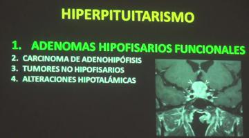 Fisiopato 2017, 12 de Junio. Hiperfunción e Hipofunción de las Glandulas Endócrinas.