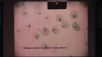 Bioquímica Clínica II 2017, 7 de Agosto.