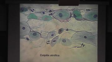 Bioquímica Clínica II 2017, 14 de Agosto. Citología. Clasificación de Tejidos.
