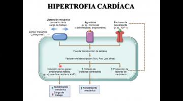 Fisiopatología 2021. Insuficiencia Cardíaca.