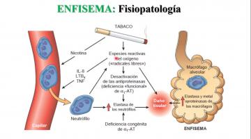 Fisiopatología 2021. Fisiopatología Respiratoria.