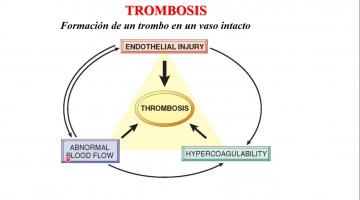 Fisiopatología 2021. Trombosis, embolia y edema.