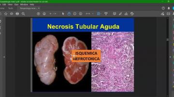 Fisiopatología 2021. Renal I.