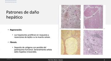 Fisiopatología 2021. Patología Hepática y Biliar I.