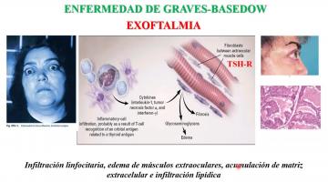 Fisiopatología 2021. Patología Endócrina.